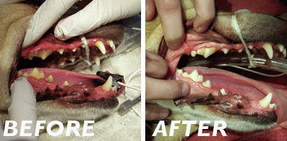 Dental Care Before and After